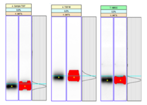Figure 4: Gasepo densitometric analysis of A‐ (left) and B‐ (middle) samples SAR‐PAGE confirmation tests (negative human EPO standard from the B‐sample test is show for comparison (right)).